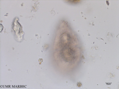 phyto/Bizerte/bizerte_bay/RISCO July 2016/Gymnodinium sp9 (Baie_T1A-dinogrand-10).tif(copy)_thumb.jpg